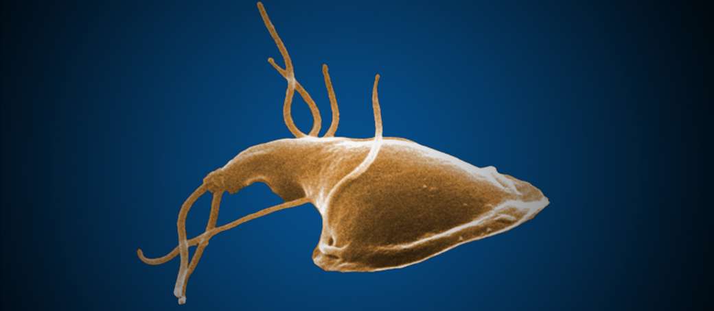 water-filter-and-water-purifier-giardia-banner